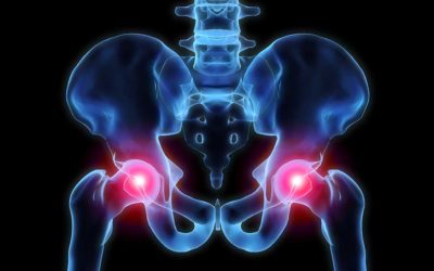 Causes of Hip Pain (and What to Do About It)