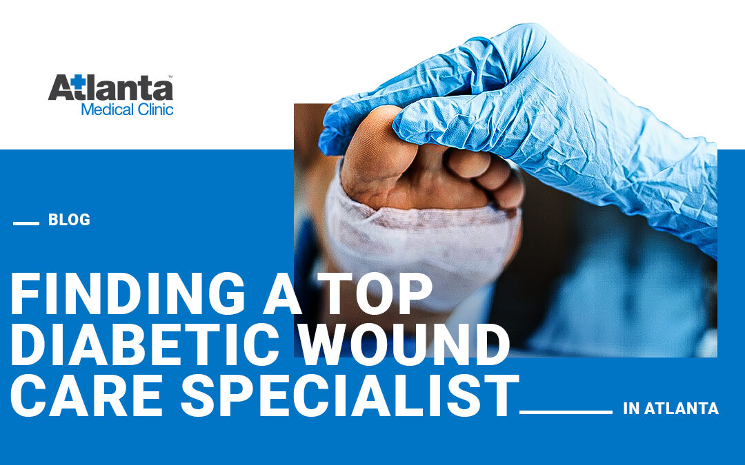 Finding a Top Diabetic Wound Care Specialist in Atlanta